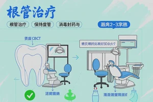 眉山家鸿口腔做根管治疗需要多少次