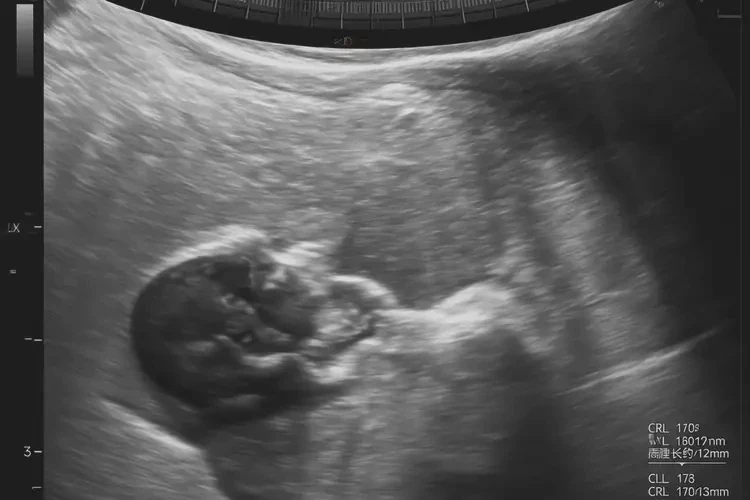 孕7周6天胎心110左右正常吗(图4)