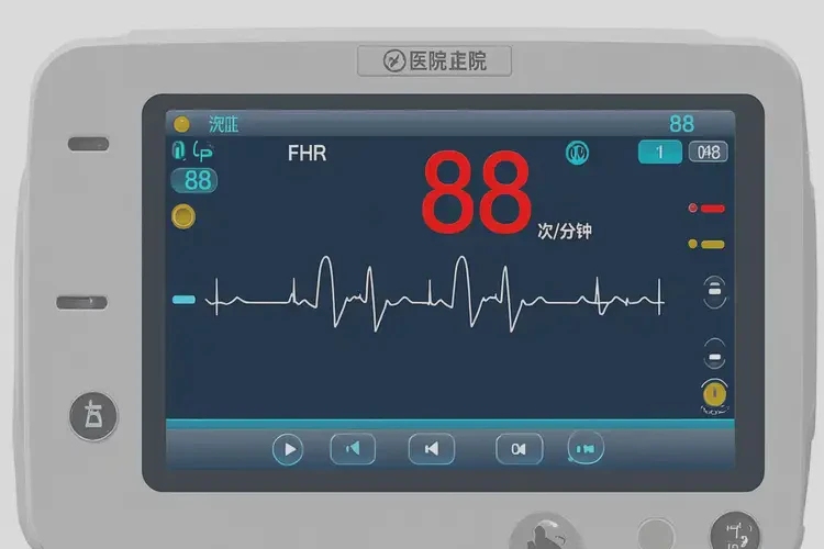 怀孕胎心88有危险吗(图1)