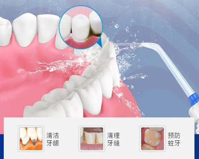 5个口腔卫生常识,能极大改善你的健康,但80%的人都不知道 -第7张图片-就爱百科 5个口腔卫生常识,能极大改善你的健康,但80%的人都不知道 -第7张图片-就爱百科