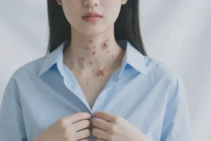 青年人脖子有湿疹不管它会自己好吗