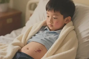 中学生肚子上经常起湿疹能够彻底治愈吗