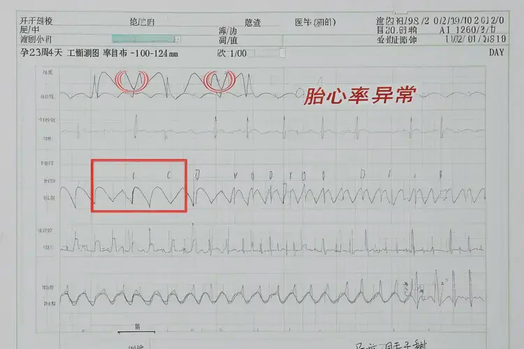 孕23周4天胎心95正常吗(图4)