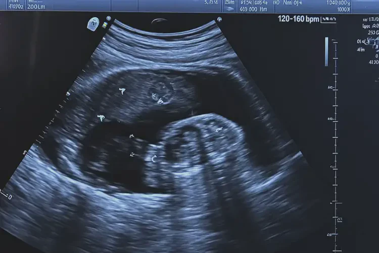 怀孕七个多月胎心160多宝宝还能要吗(图2)