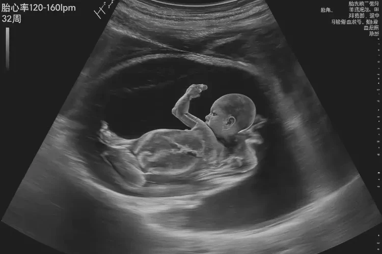 怀孕第32周胎心106正常吗(图4)