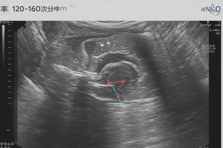 怀孕第20周胎心101正常吗(图4)