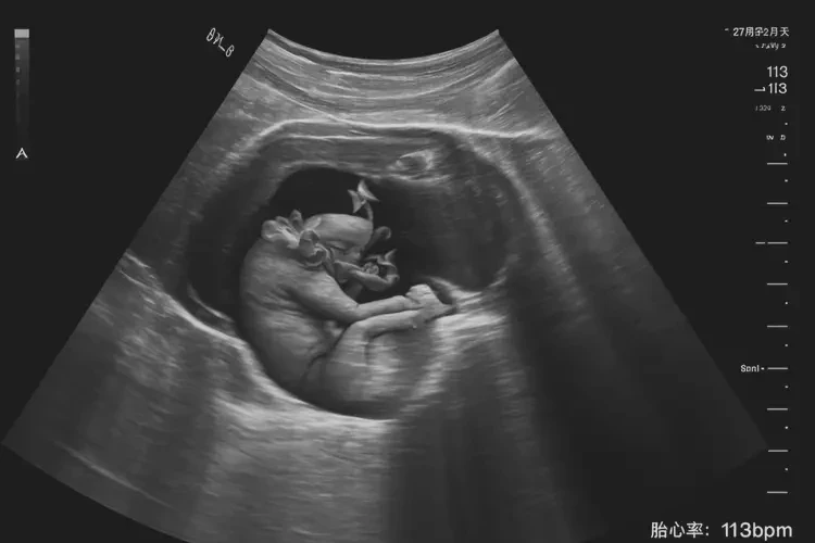 孕27周2天胎心113正常吗(图4)