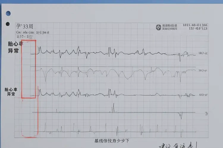 孕33周胎心84正常吗(图4)