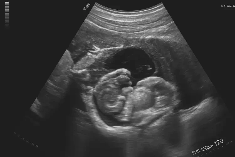 怀孕第15周胎心120正常吗(图4)
