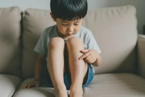 孩子小腿上有湿疹不管它会自己痊愈吗