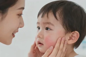 孩子面部经常长湿疹不管它会自己痊愈吗