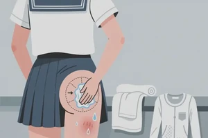 大学生屁股上经常长湿疹能够彻底治愈吗