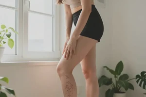 女性四肢经常长湿疹能彻底自愈吗