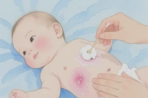 小儿肚子上容易起湿疹不管它会自己好吗