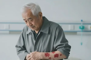 男人身上容易长湿疹能够彻底治愈吗