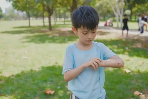 小学生手臂上有湿疹能够彻底治愈吗