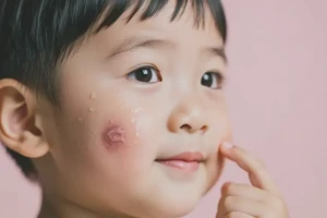 儿童脸上偶尔长湿疹不管它会自己痊愈吗