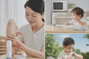 少儿全身容易长湿疹不管它会自己痊愈吗