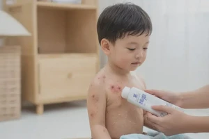 儿童脖子出现湿疹不管它会自己好吗