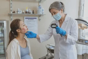 哺乳期妈妈脸上容易长湿疹不管它会自己好吗