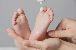 婴幼儿全身容易长湿疹可不可以根治