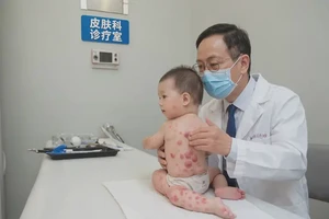 婴幼儿四肢偶尔起湿疹不管它会自己痊愈吗