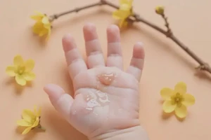 宝宝身上容易长湿疹能彻底自愈吗