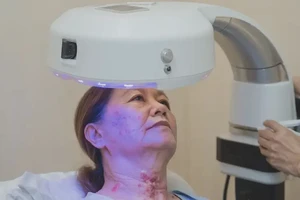 女生脖子出湿疹可以彻底自愈吗