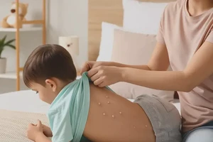 孩子身上偶尔起湿疹不管它会自己好吗