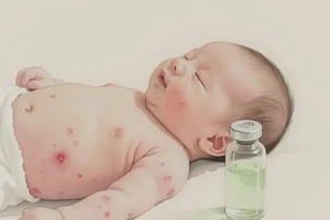 婴儿肚子上偶尔起湿疹可不可以根治