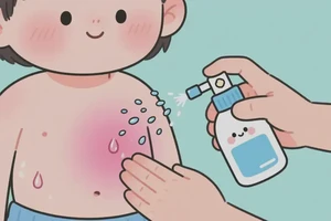 孩子肚子偶尔起湿疹能够彻底治愈吗