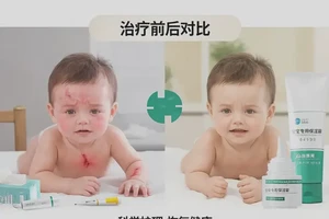 婴儿肛周起湿疹能彻底自愈吗