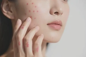 女性身上有湿疹能够彻底治愈吗